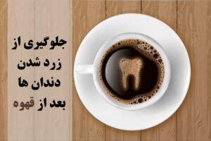 محافظت از دندان در مقابل لکه قهوه